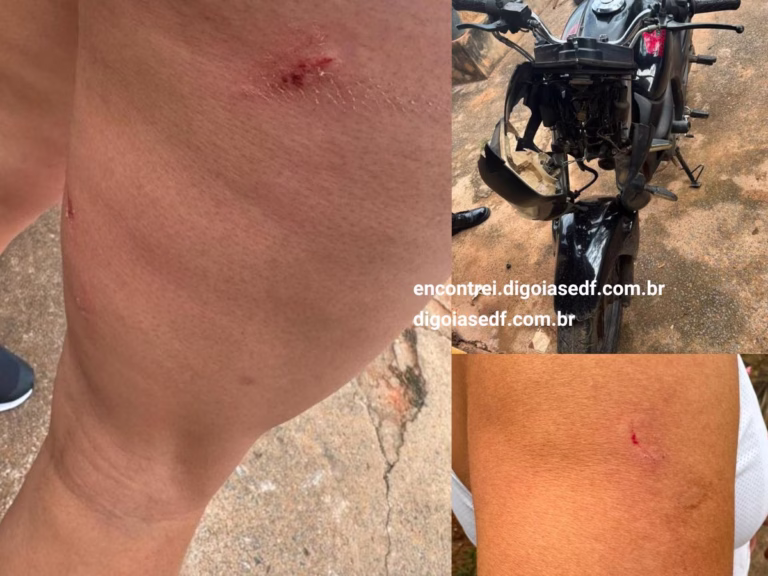 A imagem acima tem a perna machucada da mulher, o braço também ferido, e a moto destruída.