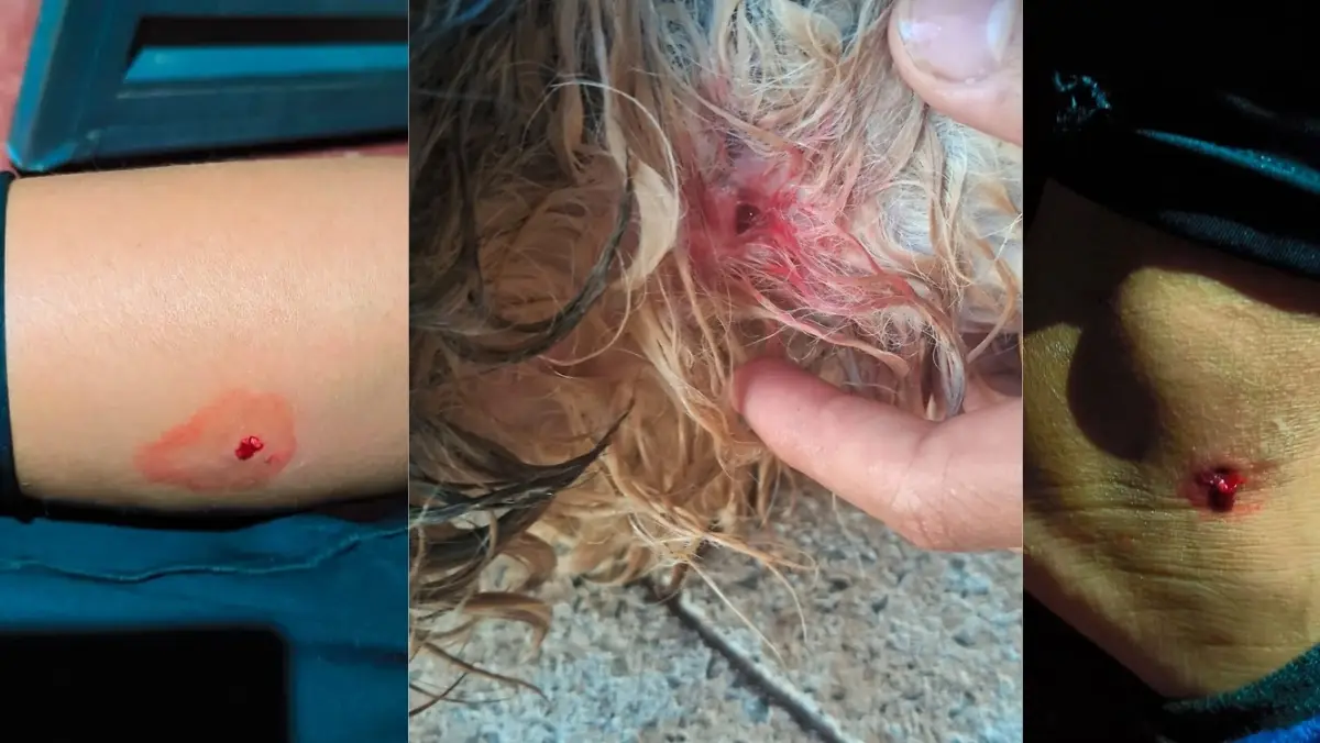 ataques por cães sem controle aterroriza moradores