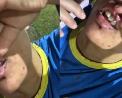 Jovem teve o lábios machucados após arremesso de celular, violência doméstica.