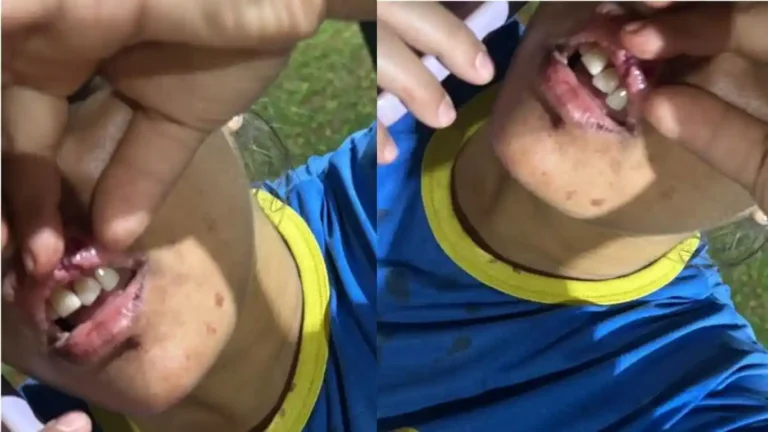Jovem teve o lábios machucados após arremesso de celular, violência doméstica.