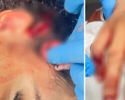 Formosa, Formosinha, adolescente esfaqueada, ataque com faca, tentativa de homicídio, Polícia Militar, Polícia Civil, GIH de Formosa, Hospital Regional de Formosa, Instagram, Goiás, Entorno do Distrito Federal.