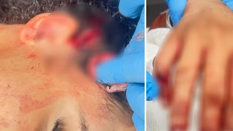 Formosa, Formosinha, adolescente esfaqueada, ataque com faca, tentativa de homicídio, Polícia Militar, Polícia Civil, GIH de Formosa, Hospital Regional de Formosa, Instagram, Goiás, Entorno do Distrito Federal.