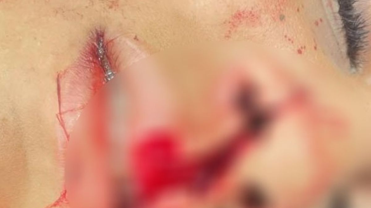 Caso de agressão contra adolescente é investigado pela Polícia Civil em Formosa, Goiás.