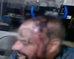 Homem denuncia agressão em Formosa após discussão no bairro Formosinha.