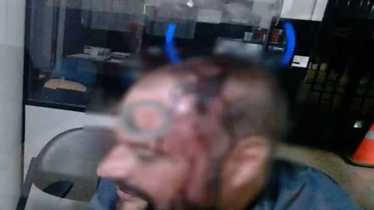 Homem denuncia agressão em Formosa após discussão no bairro Formosinha.