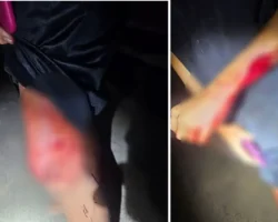 Homem esfaqueado em Cabeceiras mobiliza equipe da Polícia Militar.