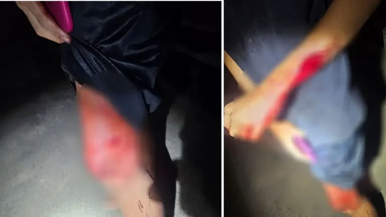 Homem esfaqueado em Cabeceiras mobiliza equipe da Polícia Militar.