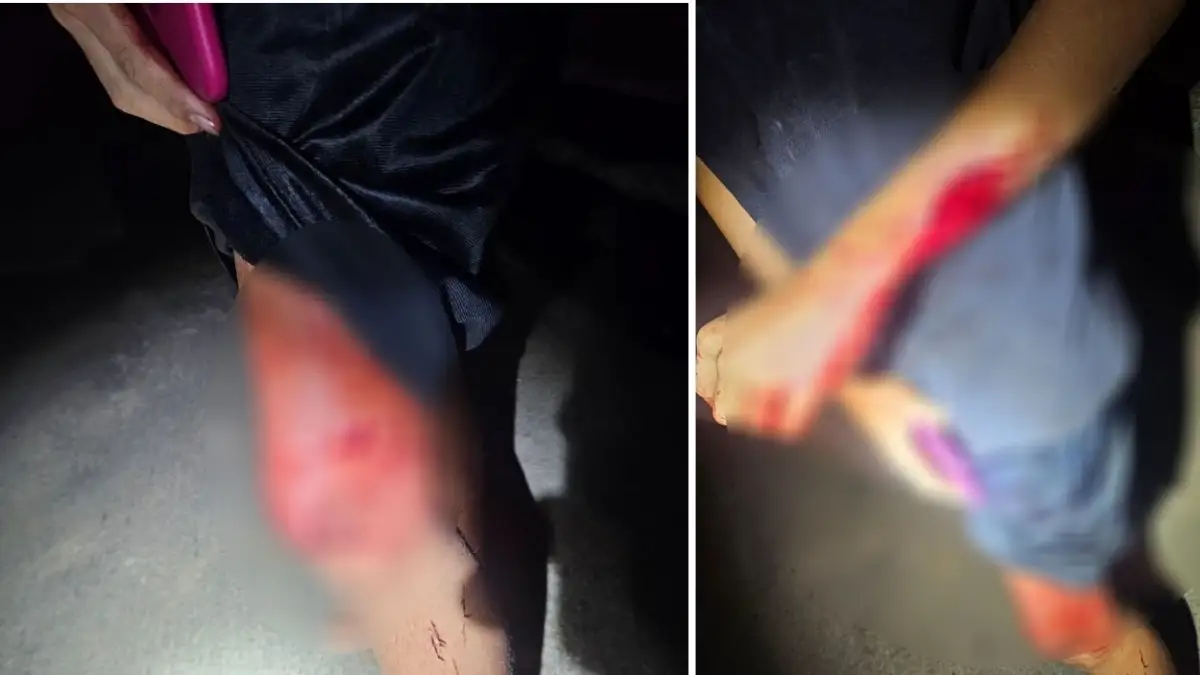 Homem esfaqueado em Cabeceiras mobiliza equipe da Polícia Militar.