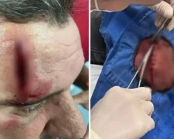 Agressão entre irmãos em Formosa após disputa por abastecimento de água