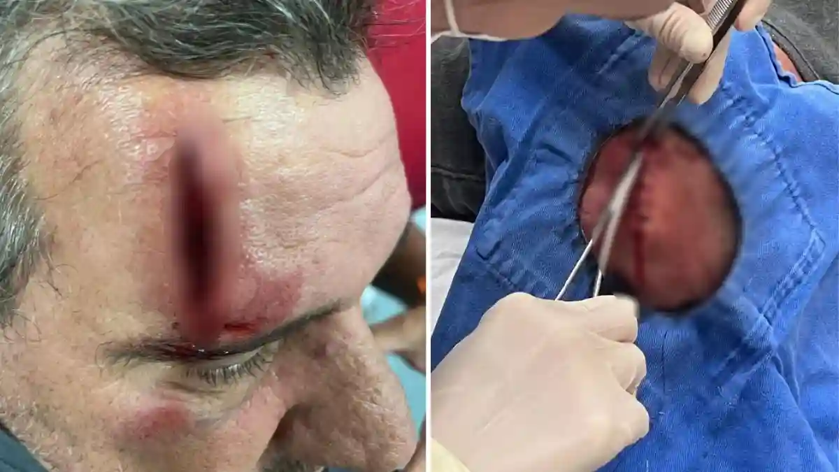 Agressão entre irmãos em Formosa após disputa por abastecimento de água